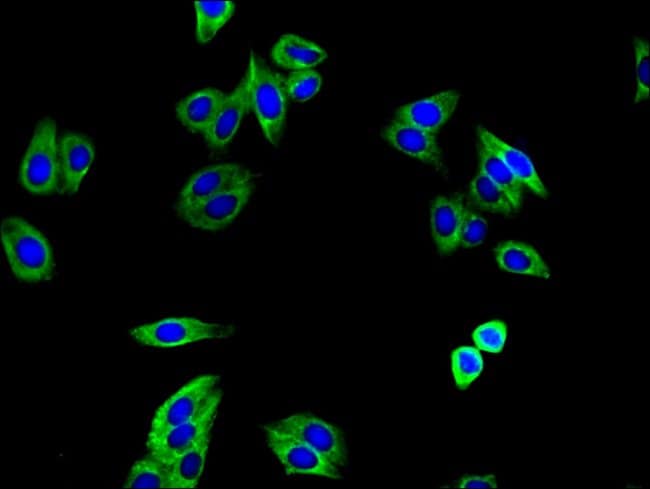100UG TGFBR1 ANTIBODY 100 ug