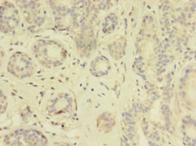 100UG TK1 ANTIBODY 100 ug