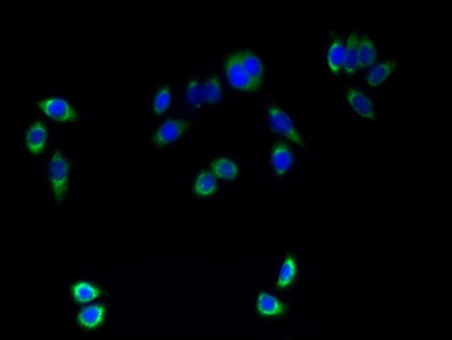 100UG TMEM161A ANTIBODY 100 ug
