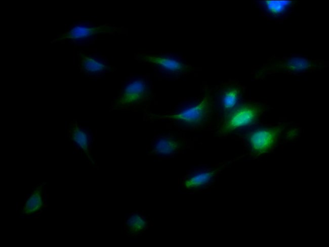 100UG TMEM192 ANTIBODY 100 ug
