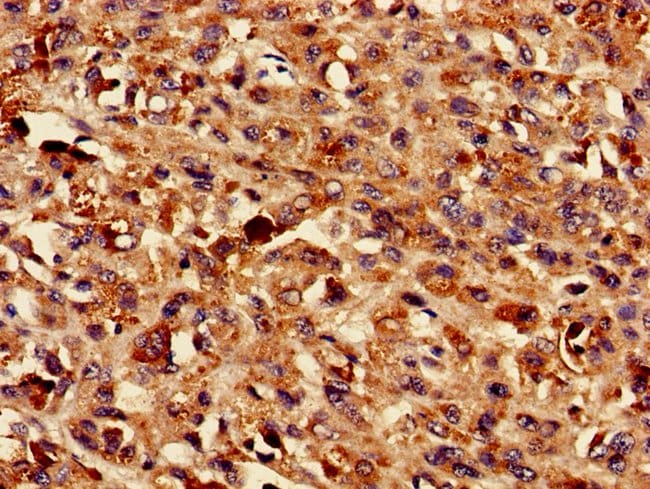 100UG TMEM43 ANTIBODY 100 ug