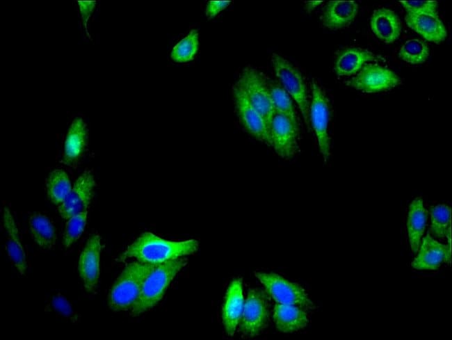 100UG TMEM59 ANTIBODY 100 ug