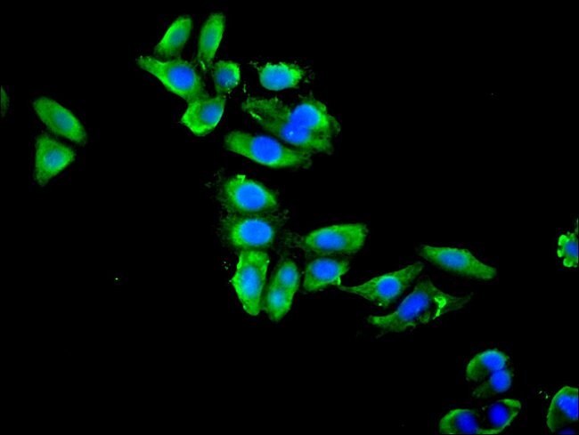 100UG ENO1 ANTIBODY 100 ug
