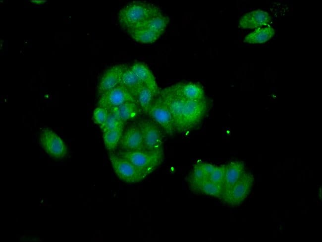 100UG TANKYRASE ANTIBODY 100 ug