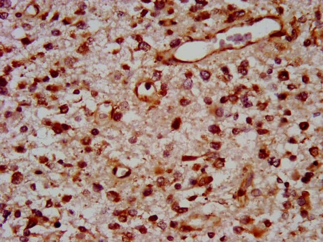 100UG TOX ANTIBODY 100 ug