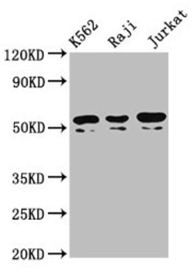 100UG TOX2 ANTIBODY 100 ug