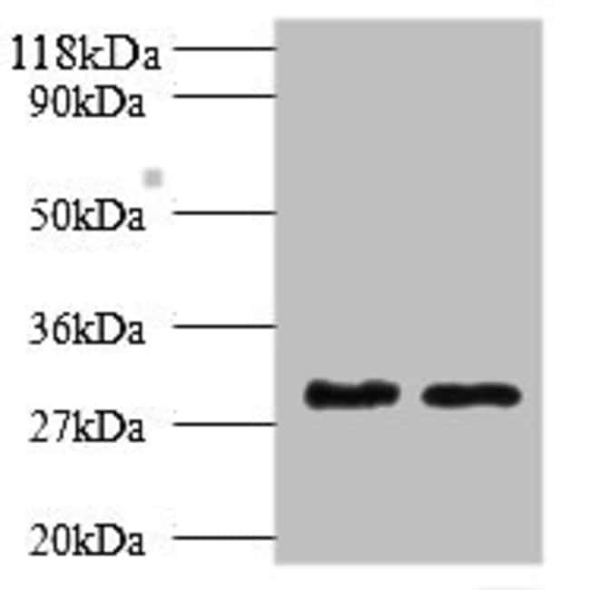 100UG TPSB2 ANTIBODY 100 ug