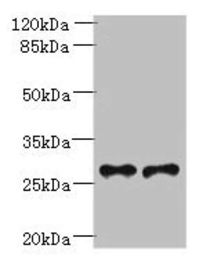 100UG TREM2 ANTIBODY 100 ug