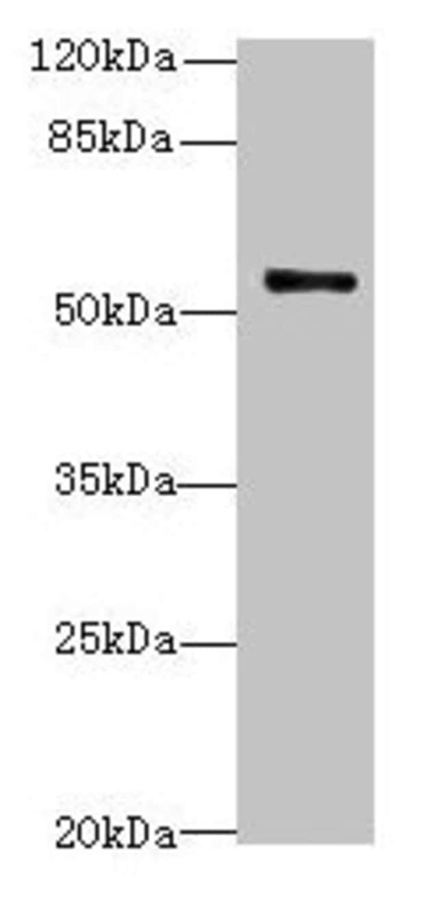 100UG TRIM38 ANTIBODY 100 ug