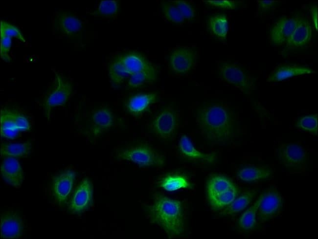 100UG TSPAN5 ANTIBODY 100 ug