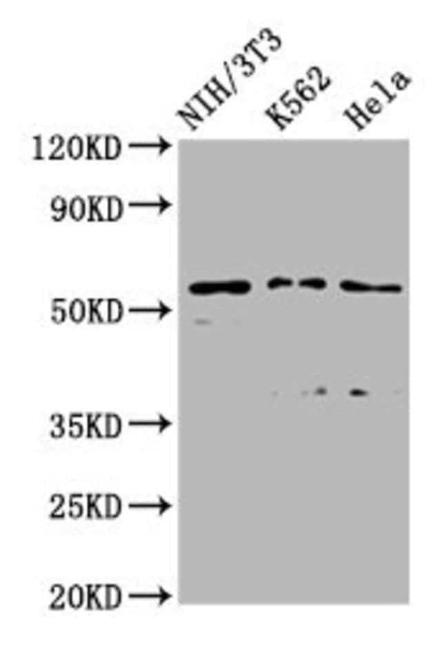100UG TTC26 ANTIBODY 100 ug