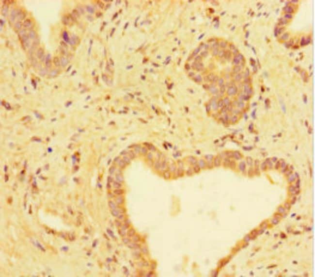 100UG ALPHA TUBULIN ANTIBODY 100 ug