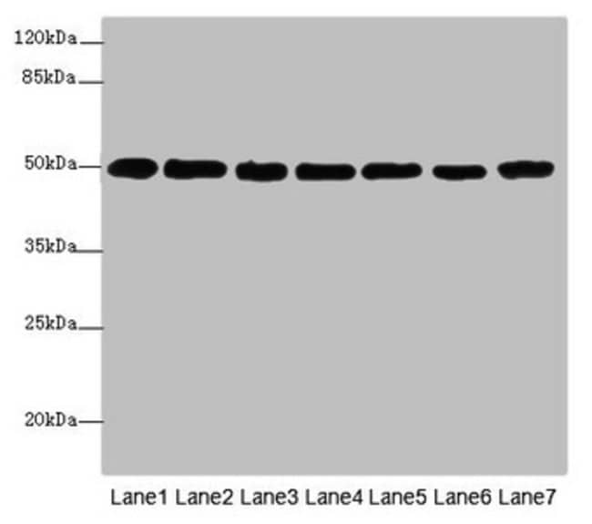 100UG BETA TUBULIN ANTIBODY 100 ug