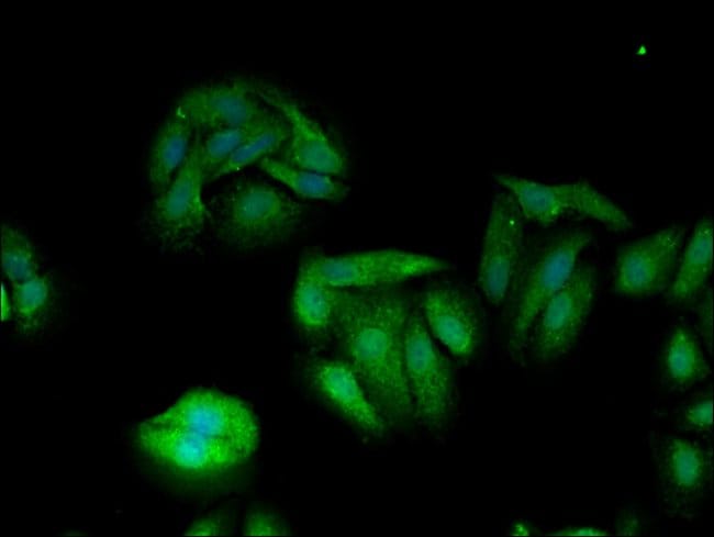 100UG TXK ANTIBODY 100 ug