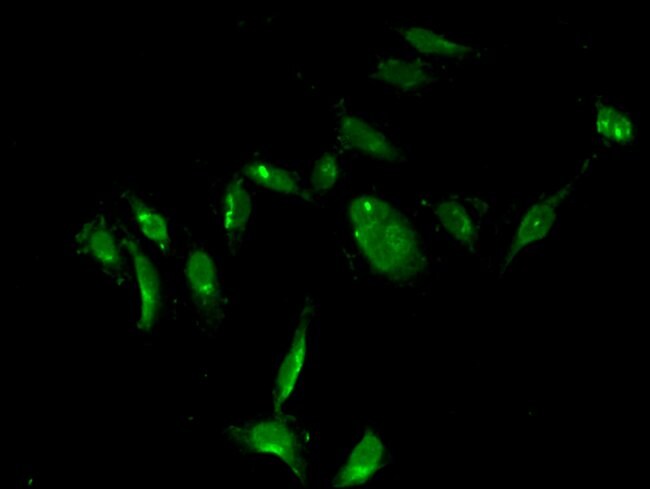 100UG THYMIDYLATE SYNTHASE ANTIBODY 100