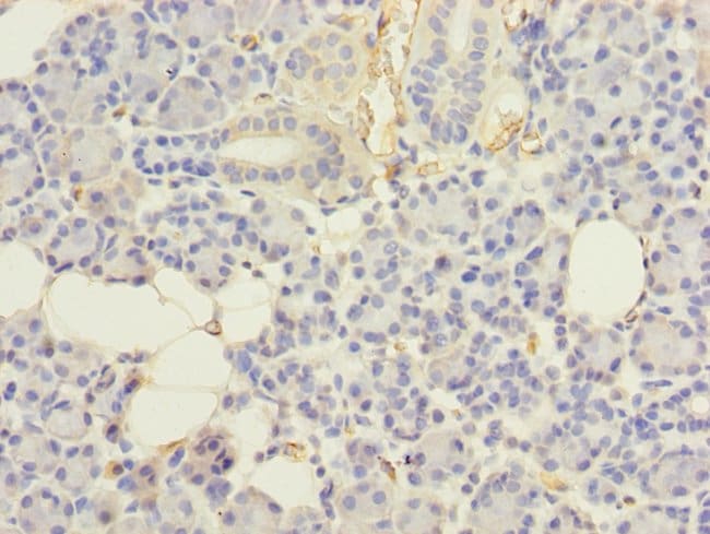 100UG UBE2G2 ANTIBODY 100 ug