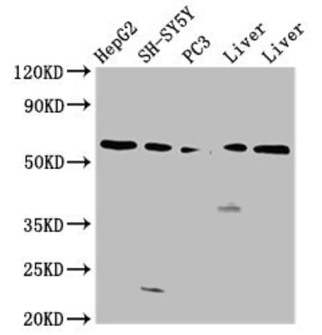 100UG UGT1A1 ANTIBODY 100 ug
