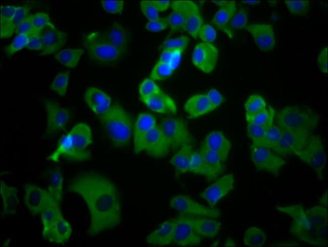 100UG UMODL1 ANTIBODY 100 ug