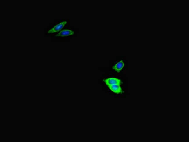 100UG USP2 ANTIBODY 100 ug