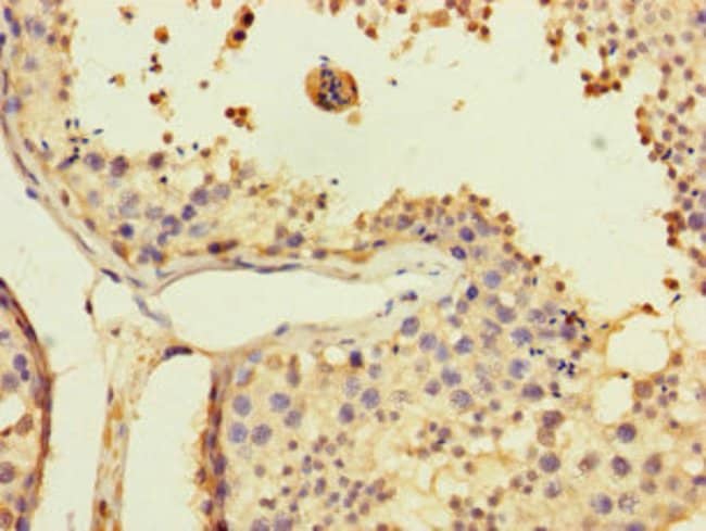 100UG USP5 ANTIBODY 100 ug