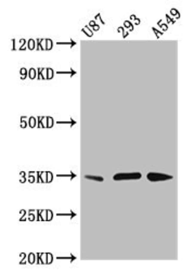100UG VAX1 ANTIBODY 100 ug