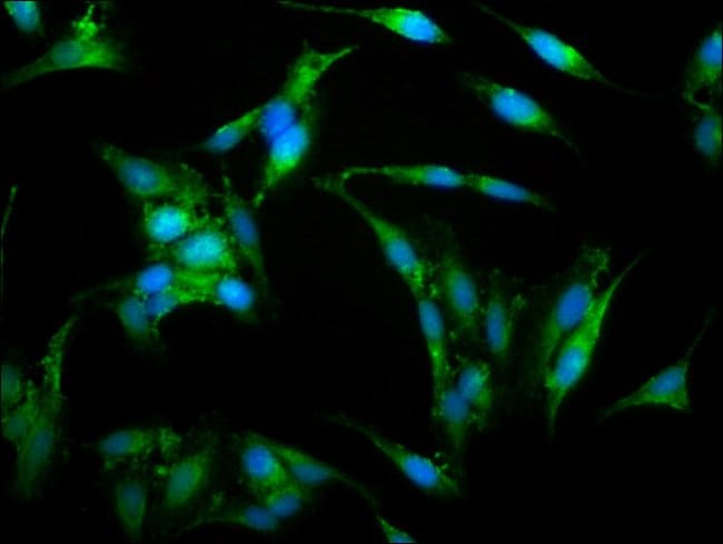 100UG WASP ANTIBODY 100 ug