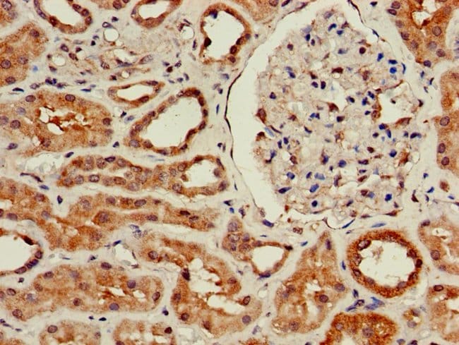 100UG WISP3 ANTIBODY 100 ug