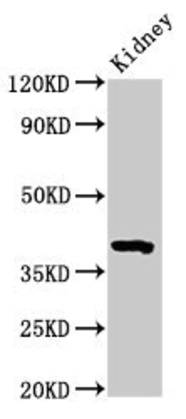 100UG WNT3 ANTIBODY 100 ug