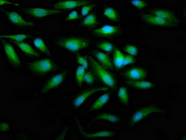 100UG ZAP-70 ANTIBODY 100 ug