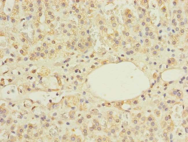 100UG ZNF297B ANTIBODY 100 ug