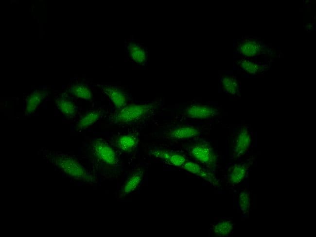 100UG ZNF133 ANTIBODY 100 ug