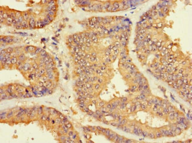 100UG ZNF2 ANTIBODY 100 ug