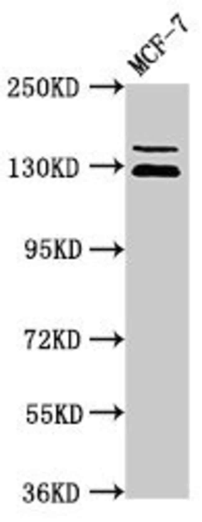 100UG ZNF335 ANTIBODY 100 ug
