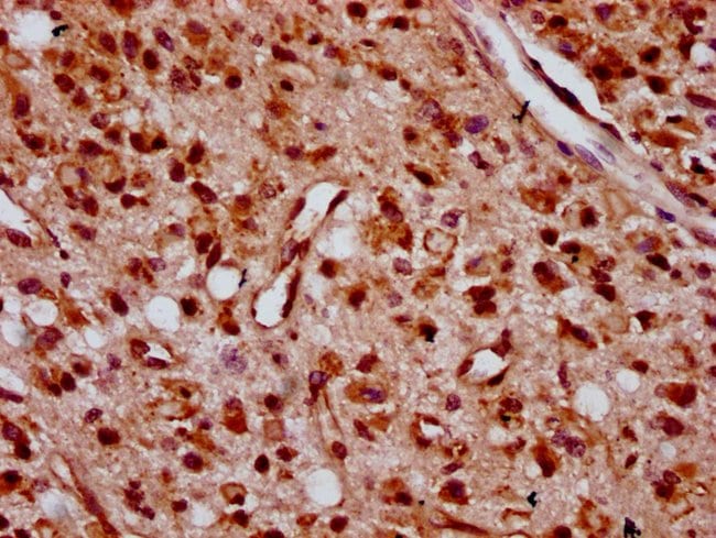 100UG ZNF367 ANTIBODY 100 ug