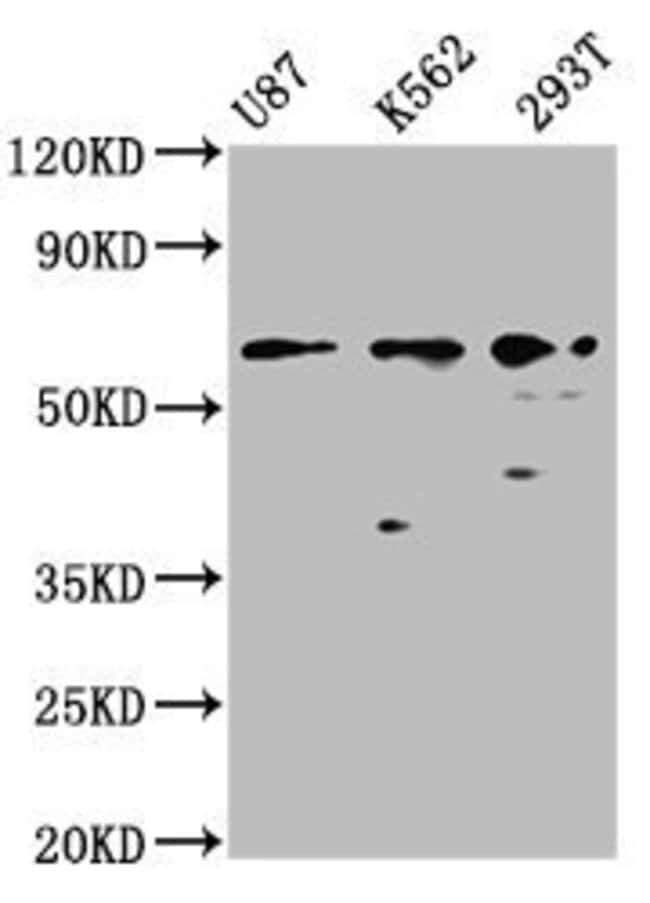 100UG ZNF37A ANTIBODY 100 ug