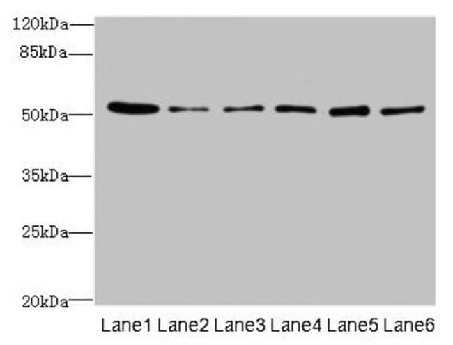 100UG ZNF398 ANTIBODY 100 ug