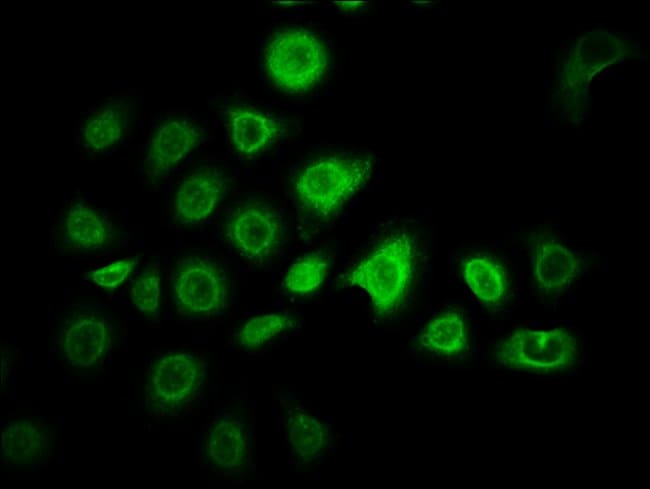 100UG ZNF488 ANTIBODY 100 ug
