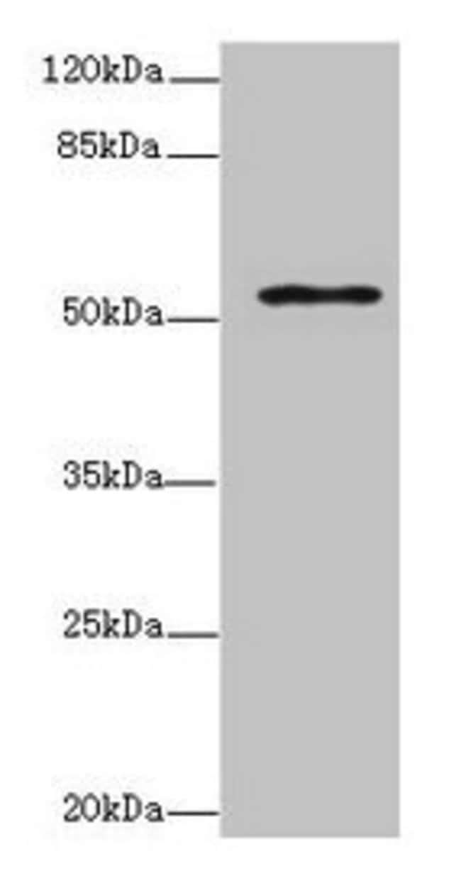 100UG ZNF610 ANTIBODY 100 ug