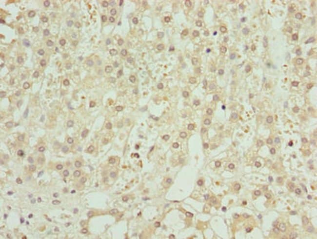 100UG ZNF821 ANTIBODY 100 ug