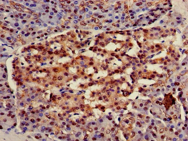 100UG HSC70 ANTIBODY 100 ug