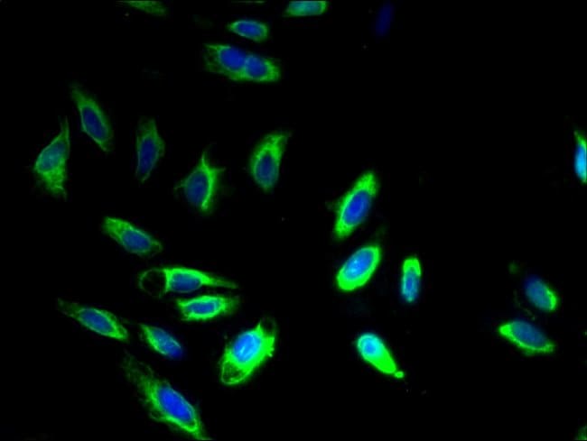 100UG BAP31 ANTIBODY 100 ug