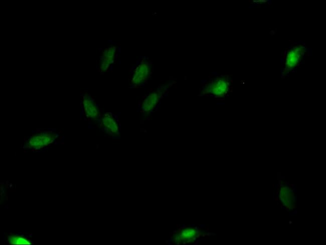 100UG C1D ANTIBODY 100 ug