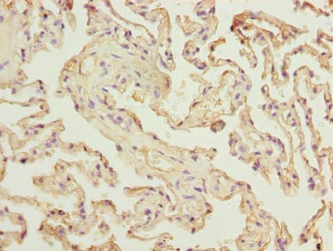 100UG RAD23A ANTIBODY 100 ug