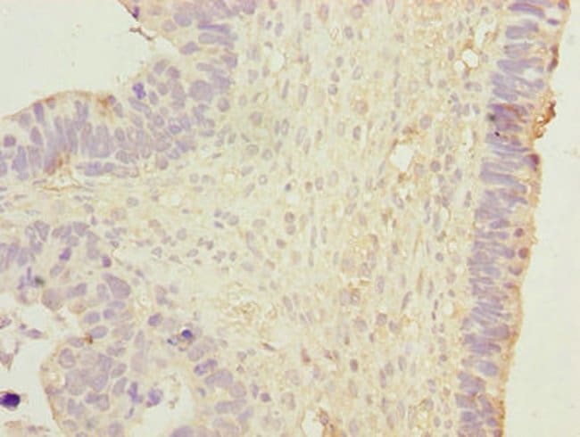 100UG HSP40 ANTIBODY 100 ug