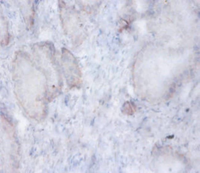 100UG AFG3L2 ANTIBODY 100 ug