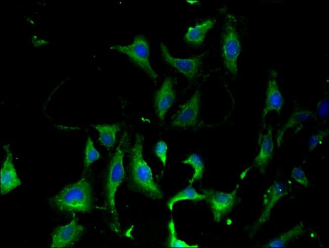 100UG KARS ANTIBODY 100 ug