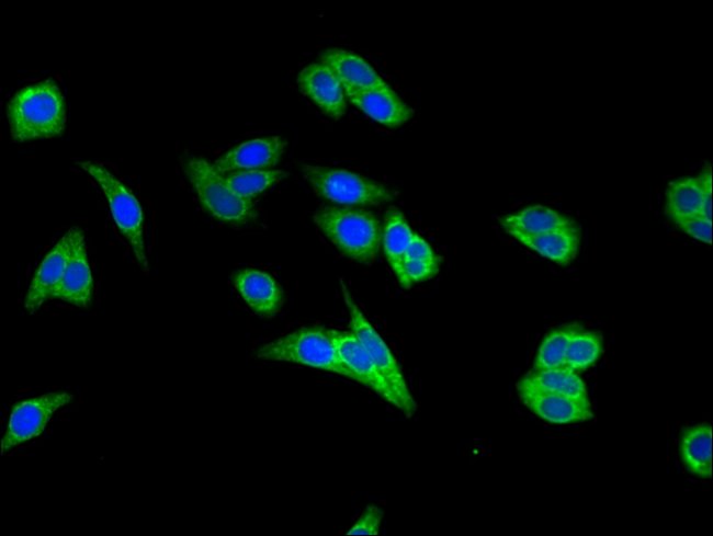 100UG MEK2 ANTIBODY 100 ug