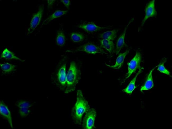 100UG CDK11A ANTIBODY 100 ug