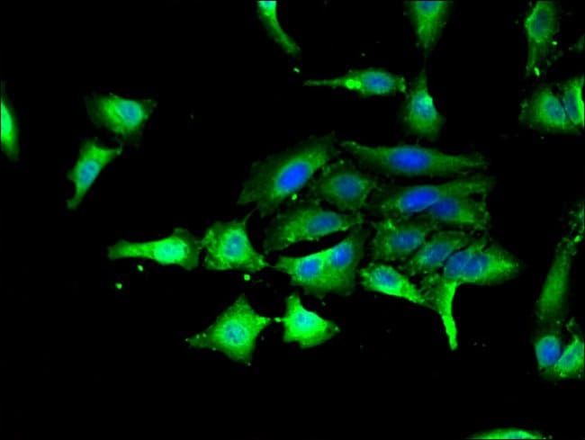 100UG GSK3 ALPHA ANTIBODY 100 ug