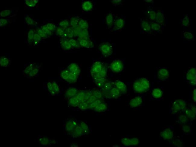 100UG API5 ANTIBODY 100 ug